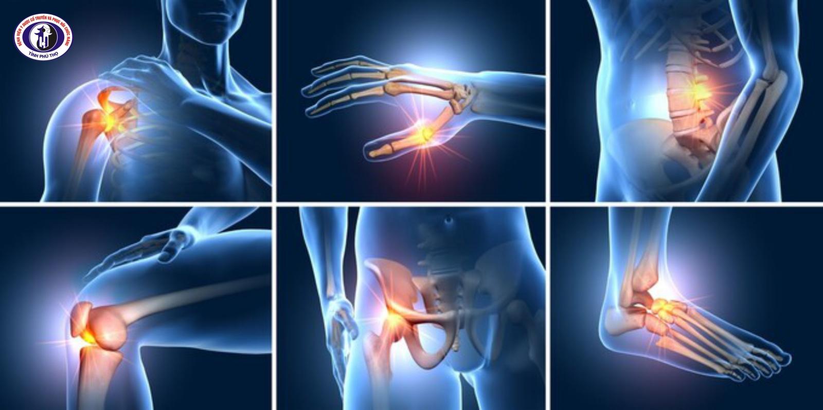 Một số hội chứng và các bệnh về đau nhức cơ xương khớp phổ biến nguy cơ cao