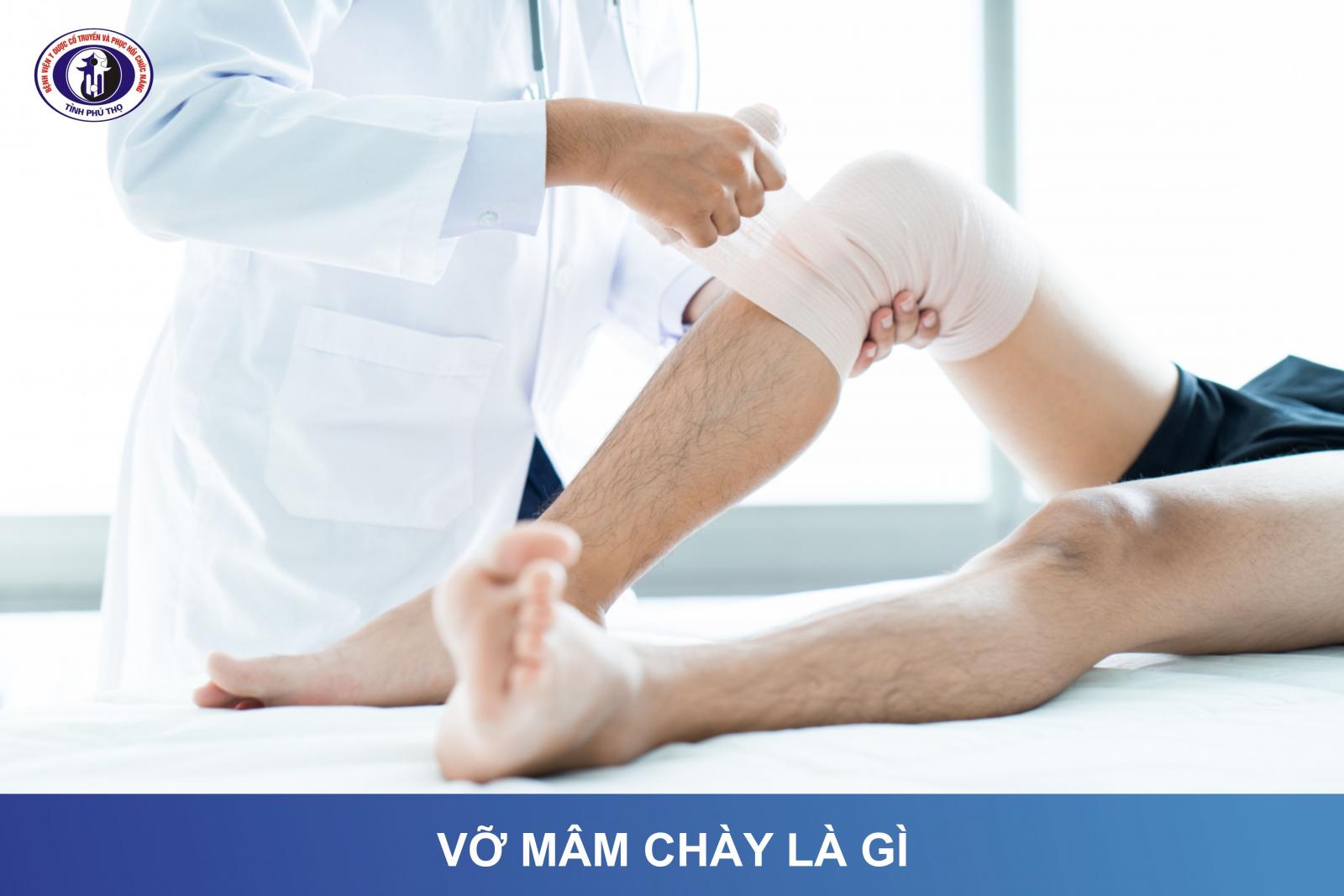 Những bài tập phục hồi chức năng vỡ mâm chày hiệu quả an toàn