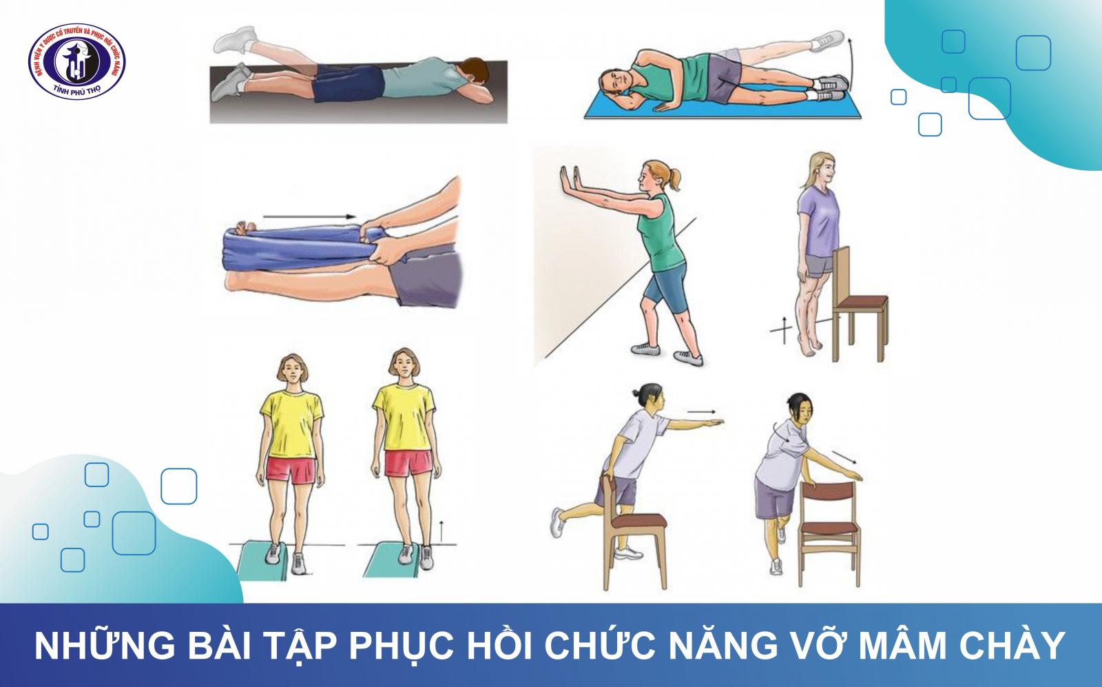 Những bài tập phục hồi chức năng vỡ mâm chày hiệu quả an toàn