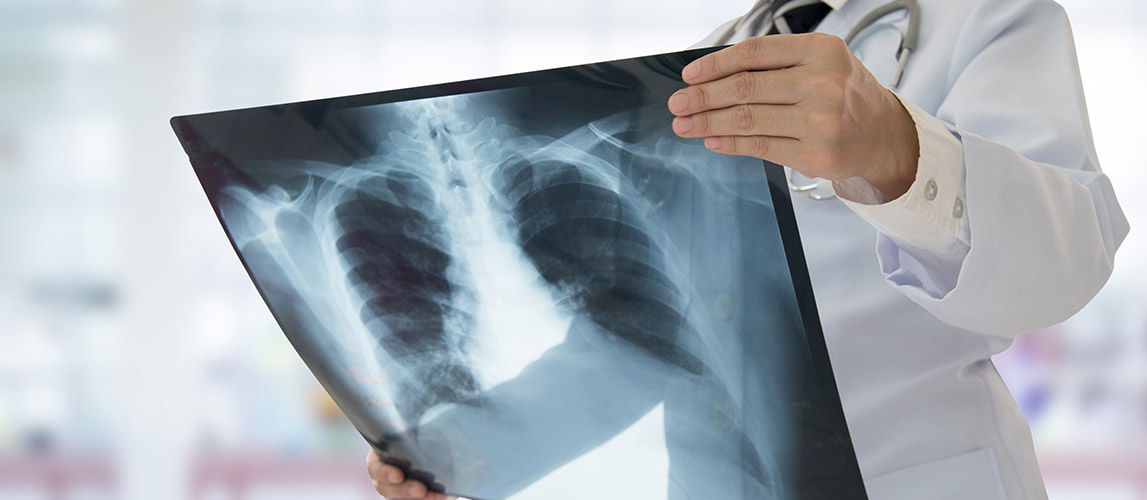 Chuẩn đoán hình ảnh